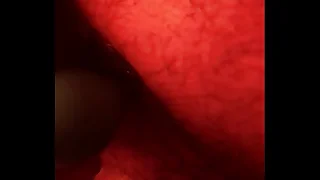 Mischievous time anal beads