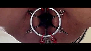 Open my aperture with a octopus claw-Part 3- 35 cm pain anal beads insertion